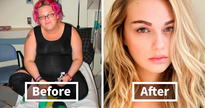 “There Is Hope”: 57 Glow-Ups So Extreme, People Barely Look Like The Same Person