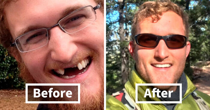 “There Is Hope”: 57 Glow-Ups So Extreme, People Barely Look Like The Same Person