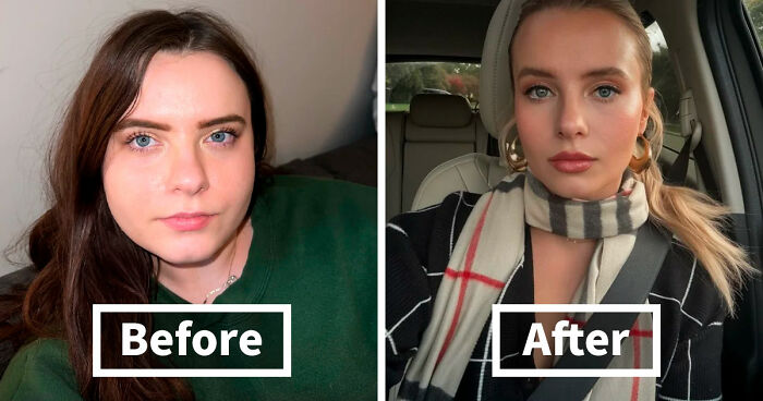 “There Is Hope”: 57 Glow-Ups So Extreme, People Barely Look Like The Same Person