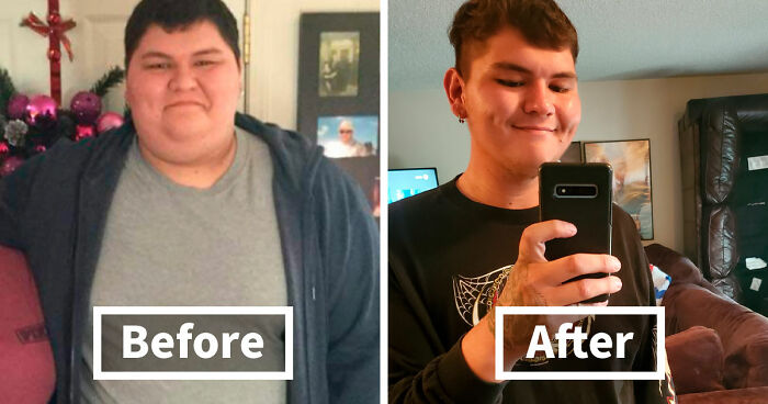 “There Is Hope”: 57 Glow-Ups So Extreme, People Barely Look Like The Same Person