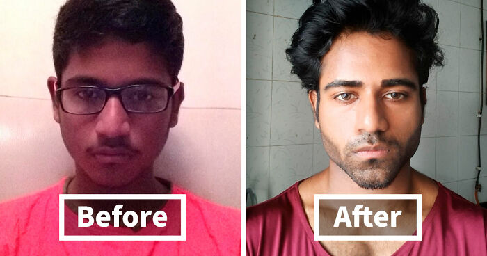 “There Is Hope”: 57 Glow-Ups So Extreme, People Barely Look Like The Same Person