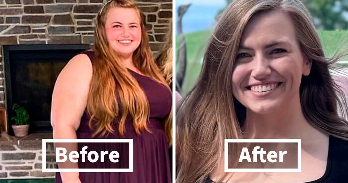 “There Is Hope”: 57 Glow-Ups So Extreme, People Barely Look Like The Same Person