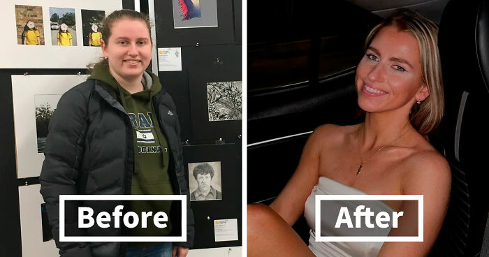 “There Is Hope”: 57 Glow-Ups So Extreme, People Barely Look Like The Same Person