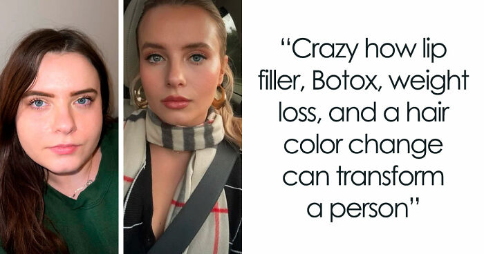 “There Is Hope”: 57 Glow-Ups So Extreme, People Barely Look Like The Same Person