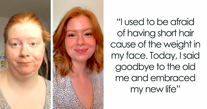 “There Is Hope”: 57 Glow-Ups So Extreme, People Barely Look Like The Same Person