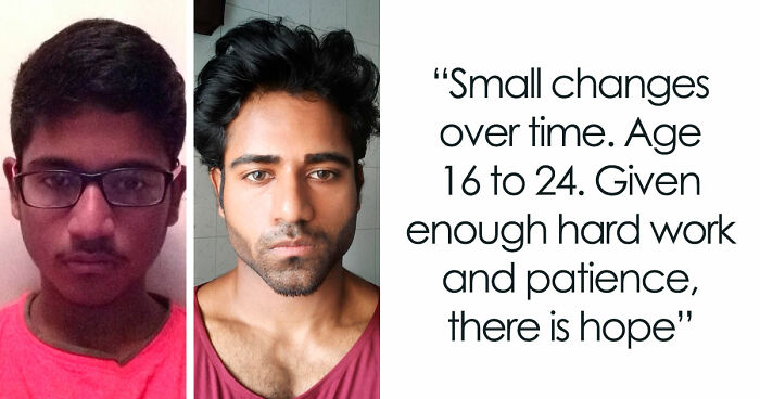 “There Is Hope”: 57 Glow-Ups So Extreme, People Barely Look Like The Same Person