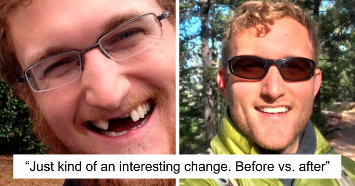 “There Is Hope”: 57 Glow-Ups So Extreme, People Barely Look Like The Same Person