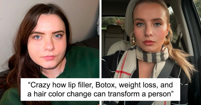 “There Is Hope”: 57 Glow-Ups So Extreme, People Barely Look Like The Same Person