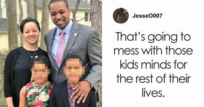 “Pressure Washer”: 47 Dumb Ways People Got Scars, And It’s Painfully Relatable