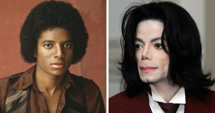 “Best Facial Harmonization I’ve Ever Seen”: 25 Before-And-Afters By A Plastic Surgeon Whose Work Went Viral