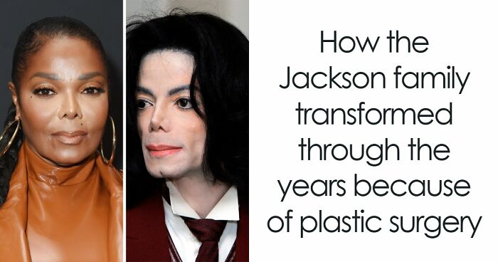 “Best Facial Harmonization I’ve Ever Seen”: 25 Before-And-Afters By A Plastic Surgeon Whose Work Went Viral