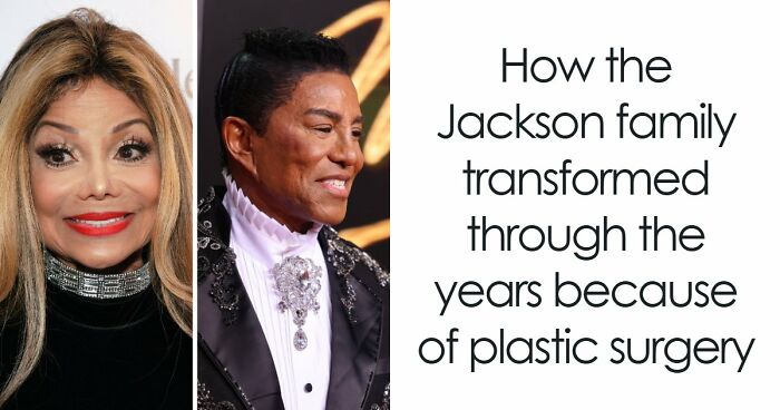 “Best Facial Harmonization I’ve Ever Seen”: 25 Before-And-Afters By A Plastic Surgeon Whose Work Went Viral