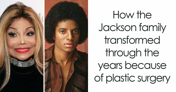 “Best Facial Harmonization I’ve Ever Seen”: 25 Before-And-Afters By A Plastic Surgeon Whose Work Went Viral