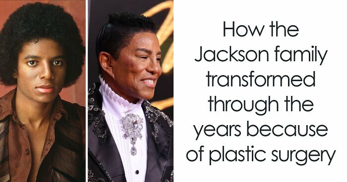 “Best Facial Harmonization I’ve Ever Seen”: 25 Before-And-Afters By A Plastic Surgeon Whose Work Went Viral