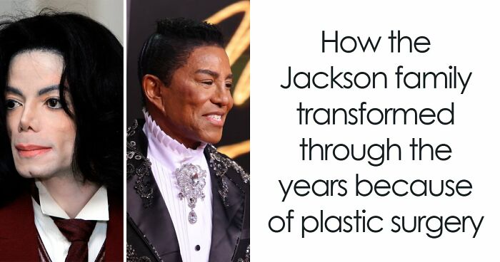 “Best Facial Harmonization I’ve Ever Seen”: 25 Before-And-Afters By A Plastic Surgeon Whose Work Went Viral