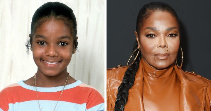 “Best Facial Harmonization I’ve Ever Seen”: 25 Before-And-Afters By A Plastic Surgeon Whose Work Went Viral