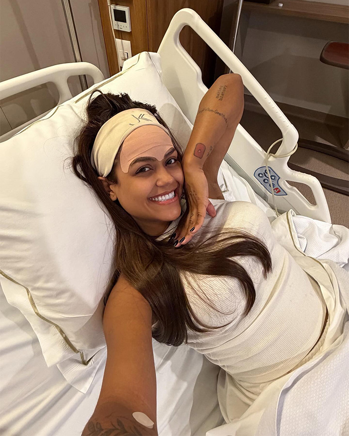 This Influencer Removed A Vein From Her Forehead Because It Bothered Her Aesthetically And Shared The Results