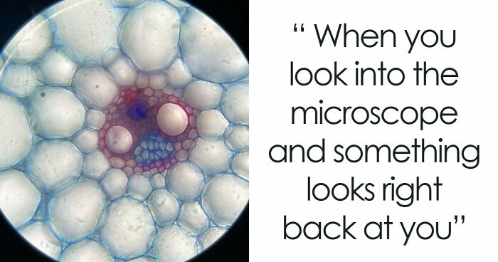 72 Unbelievable Microscope Images That Look Like They’re From Another Planet