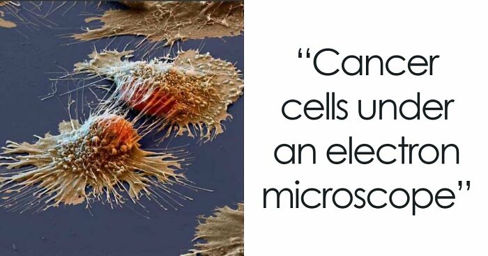 72 Unbelievable Microscope Images That Look Like They’re From Another Planet