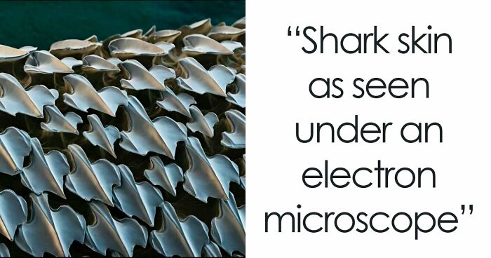 72 Remarkable Microscopic Pictures Showing Things Up-Close You Probably Have Never Seen