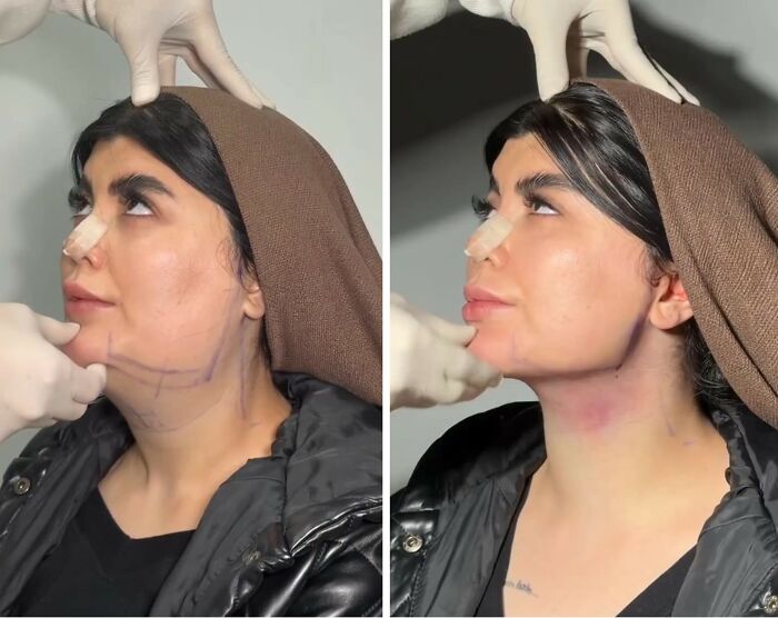 These Viral Face Transformations Look Like Something Is “Snapping” Into Place — And People Are Obsessed (21 Pics)- Interview