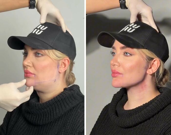 These Viral Face Transformations Look Like Something Is “Snapping” Into Place — And People Are Obsessed (21 Pics)- Interview