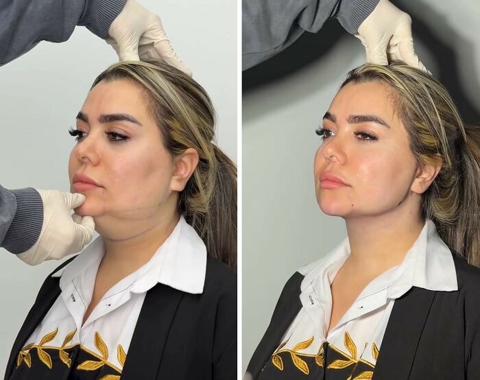 These Viral Face Transformations Look Like Something Is “Snapping” Into Place — And People Are Obsessed (21 Pics)- Interview