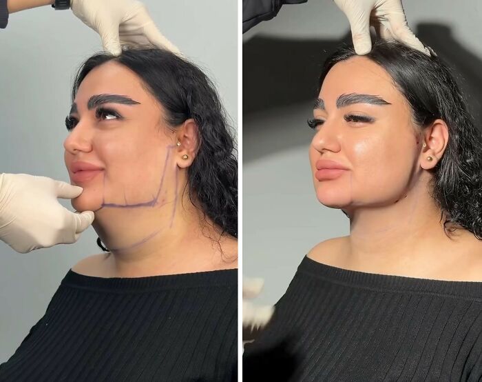 These Viral Face Transformations Look Like Something Is “Snapping” Into Place — And People Are Obsessed (21 Pics)- Interview
