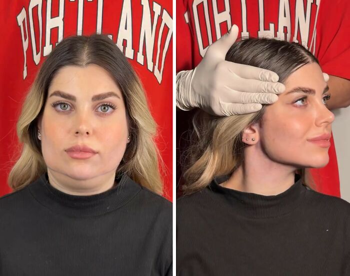 These Viral Face Transformations Look Like Something Is “Snapping” Into Place — And People Are Obsessed (21 Pics)- Interview