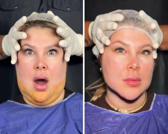 These Viral Face Transformations Look Like Something Is “Snapping” Into Place — And People Are Obsessed (21 Pics)- Interview