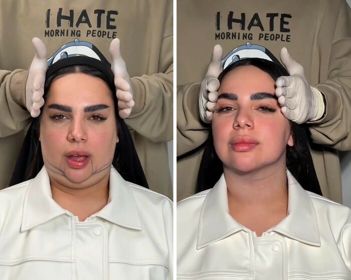 These Viral Face Transformations Look Like Something Is “Snapping” Into Place — And People Are Obsessed (21 Pics)- Interview