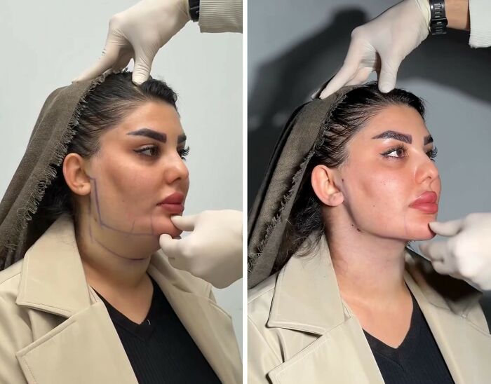 These Viral Face Transformations Look Like Something Is “Snapping” Into Place — And People Are Obsessed (21 Pics)- Interview