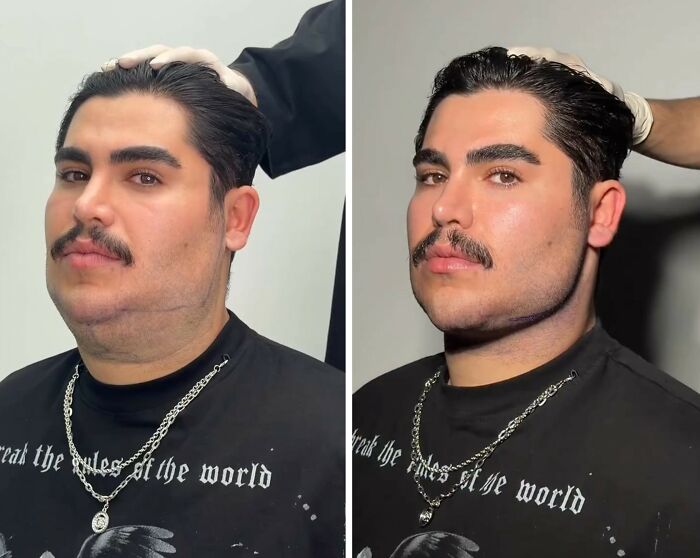 These Viral Face Transformations Look Like Something Is “Snapping” Into Place — And People Are Obsessed (21 Pics)- Interview