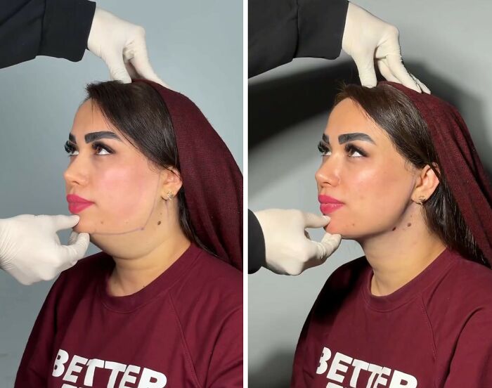 These Viral Face Transformations Look Like Something Is “Snapping” Into Place — And People Are Obsessed (21 Pics)- Interview