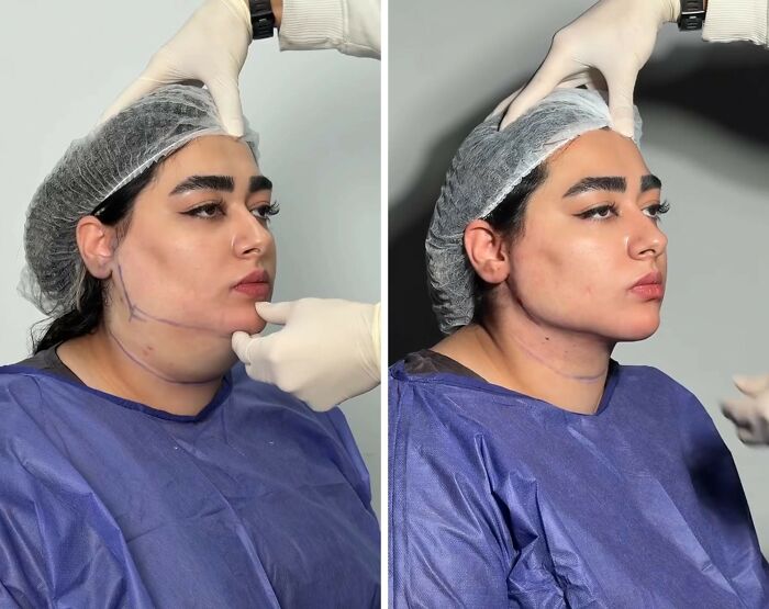 These Viral Face Transformations Look Like Something Is “Snapping” Into Place — And People Are Obsessed (21 Pics)- Interview