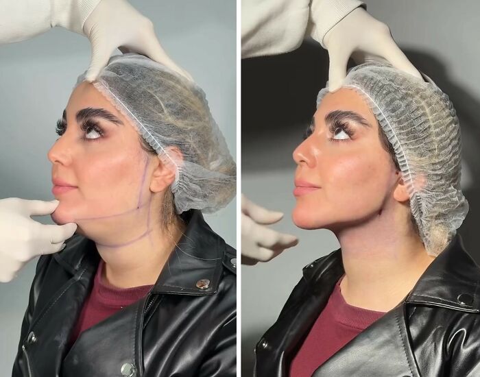 These Viral Face Transformations Look Like Something Is “Snapping” Into Place — And People Are Obsessed (21 Pics)- Interview