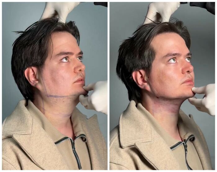 These Viral Face Transformations Look Like Something Is “Snapping” Into Place — And People Are Obsessed (21 Pics)- Interview