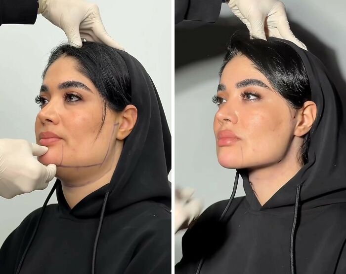 These Viral Face Transformations Look Like Something Is “Snapping” Into Place — And People Are Obsessed (21 Pics)- Interview