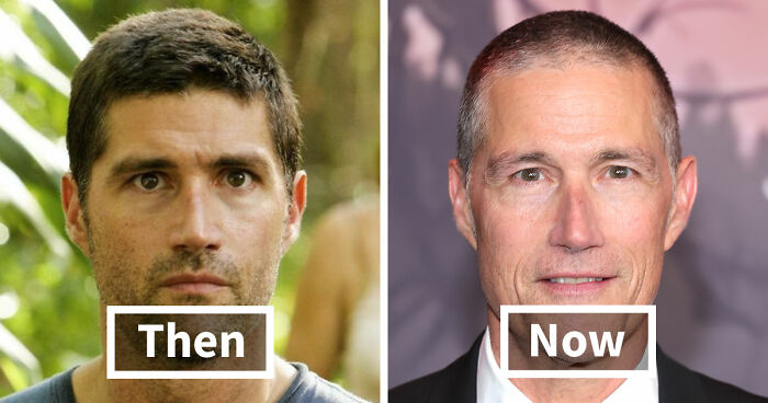 “She Was So Cute Before”: How Plastic Surgery Changed The Jackson Family Over The Years