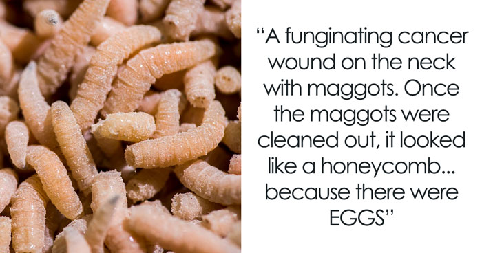 28 Nasty And Revolting Things Medical Workers Witnessed And Badly Wish They Could Unsee