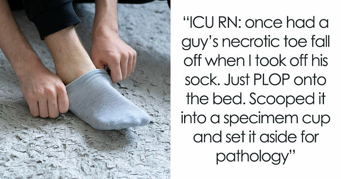 28 Nasty And Revolting Things Medical Workers Witnessed And Badly Wish They Could Unsee