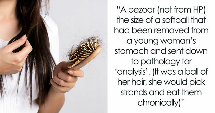 28 Nasty And Revolting Things Medical Workers Witnessed And Badly Wish They Could Unsee