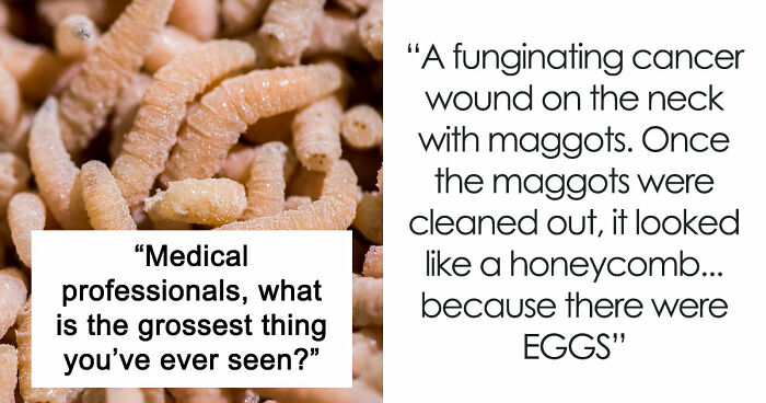 28 Nasty And Revolting Things Medical Workers Witnessed And Badly Wish They Could Unsee