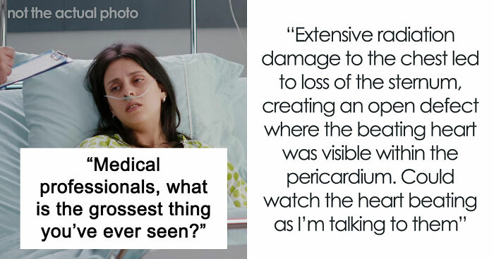 28 Nasty And Revolting Things Medical Workers Witnessed And Badly Wish They Could Unsee