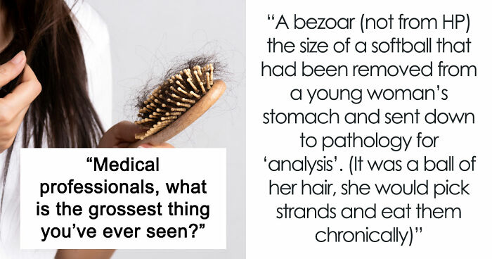 28 Nasty And Revolting Things Medical Workers Witnessed And Badly Wish They Could Unsee