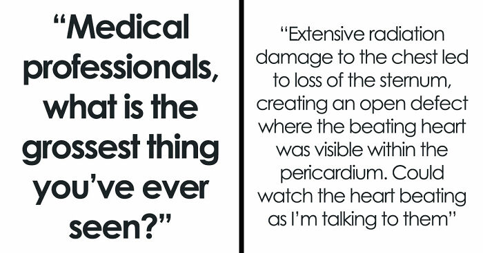 28 Nasty And Revolting Things Medical Workers Witnessed And Badly Wish They Could Unsee