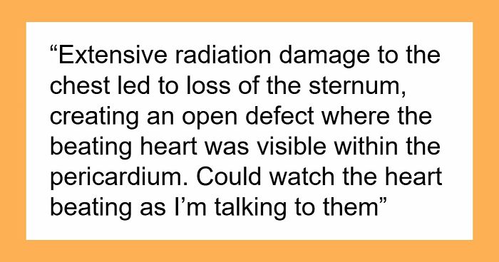28 Nasty And Revolting Things Medical Workers Witnessed And Badly Wish They Could Unsee