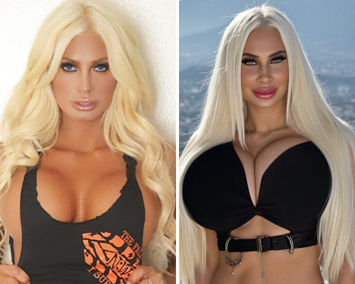 Kristi Noem&rsquo;s Husband Allegedly Bankrolled Model&rsquo;s Dramatic Transformation And Lavish Lifestyle in Secret Relationship