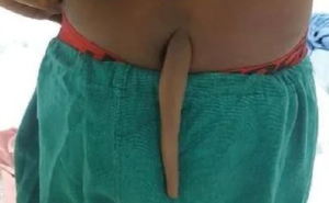 Most Of Us Walk Around Unaware Of These Bizarre Human Body Quirks – Odds Are, You Have Them Too