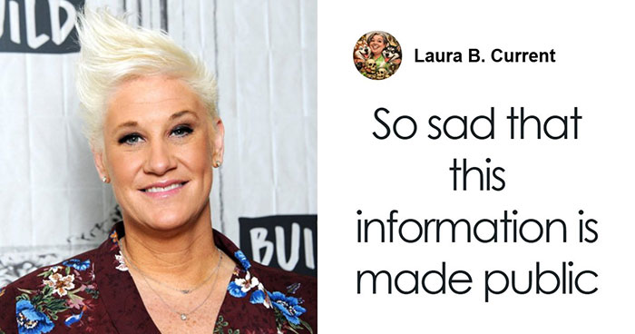 People Share 65 Photos Of The Unusual Things That Happened To Their Bodies